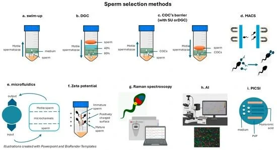 Rahul Manoj: Sperm Preparation Techniques for IVF and ICSI