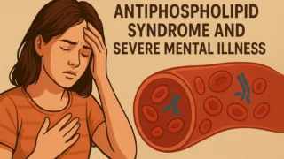 New Evidence Links APS Antibodies to Severe Mental Illness - Thrombosis Update