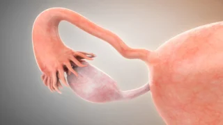 Emerging Treatments for Premature Ovarian Insufficiency - IVI RMA Global