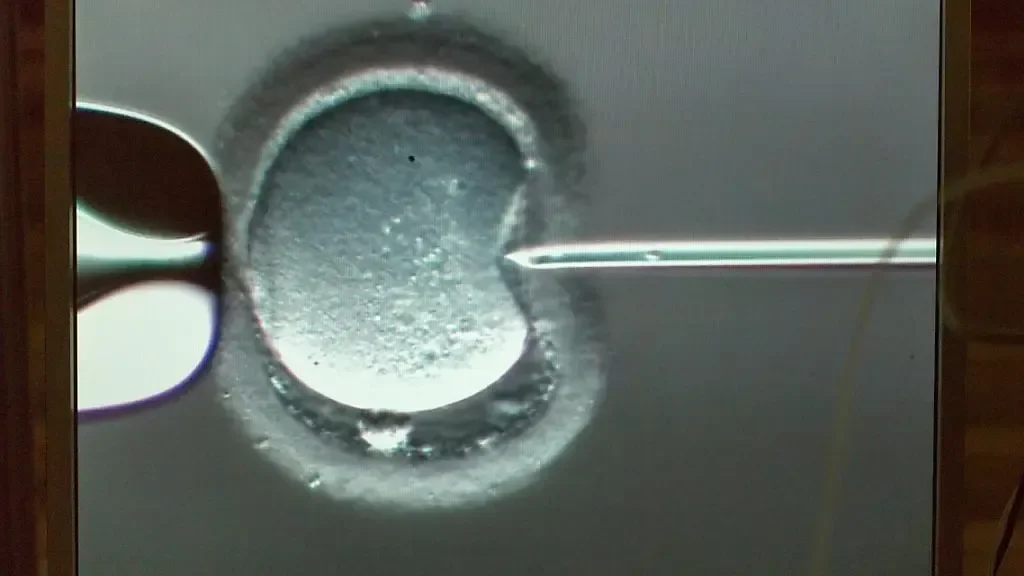 Magali Russell: Switzerland to Reform Fertility Laws in 2025 for Couples, Singles, and LGBTQ+ Families