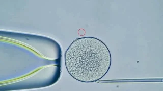 How Sleep Patterns Affect Embryo Implantation - Esraa Atef