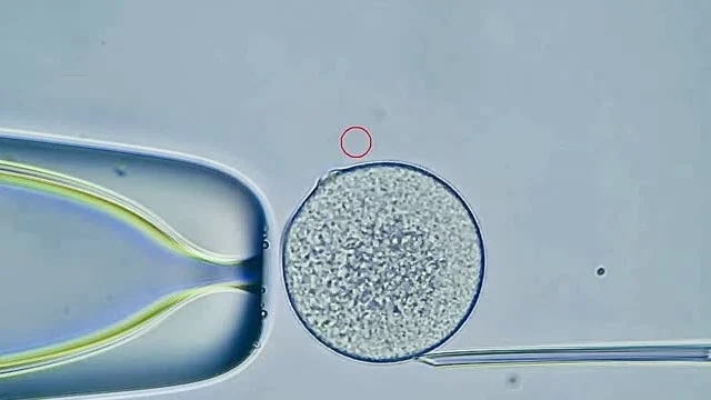 How Sleep Patterns Affect Embryo Implantation – Esraa Atef