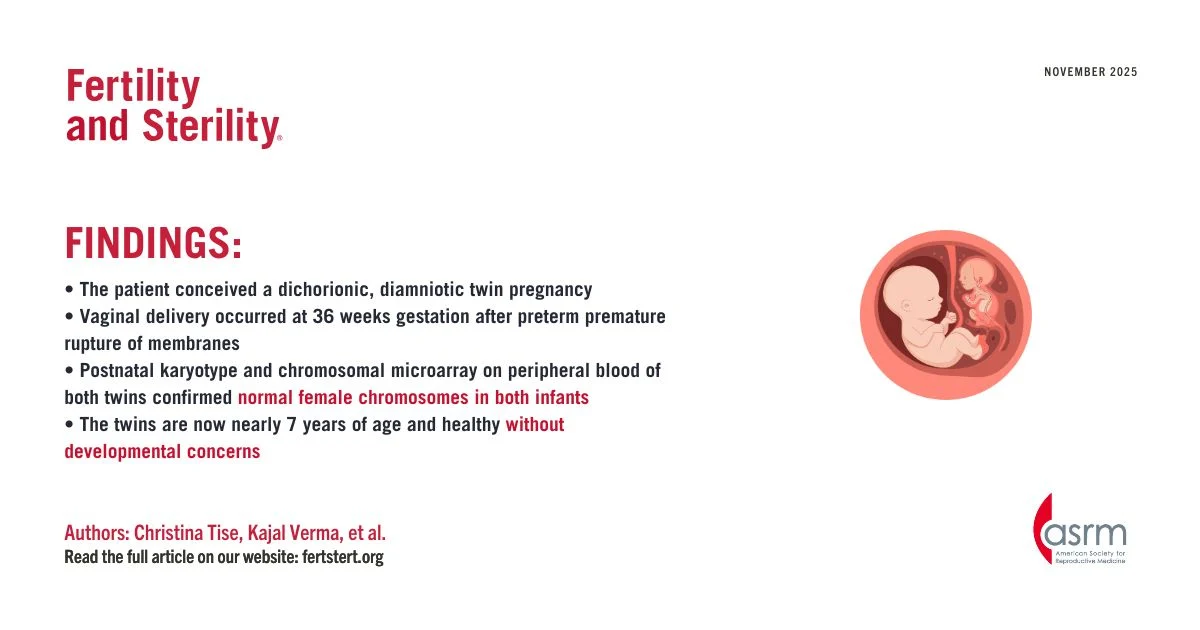 Healthy Twin Birth After Transfer of Nonmosaic Aneuploid Embryos – Fertility and Sterility