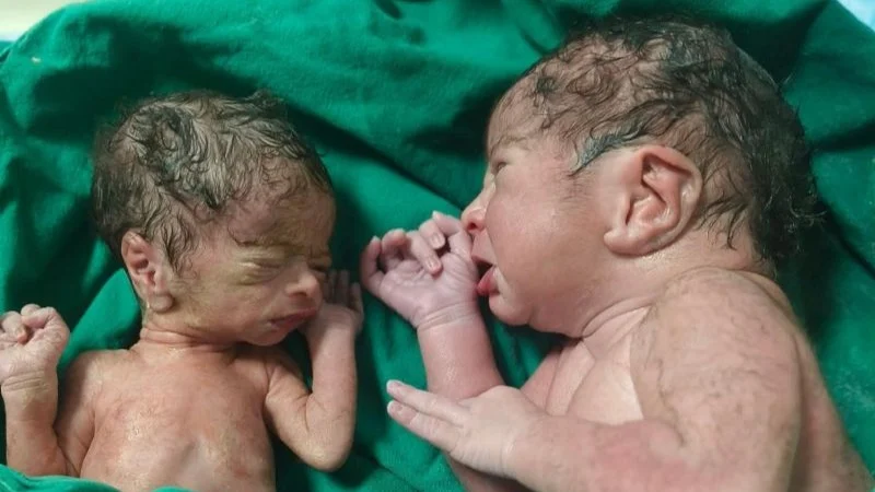 Exploring the Mysteries of Superfetation in Pregnancy – Fellow Nurses Africa