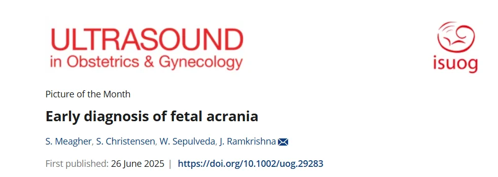 Fetal Acrania