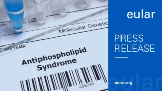 New Score Quantifying Disease Activity in Patients With Antiphospholipid Syndrome - EULAR