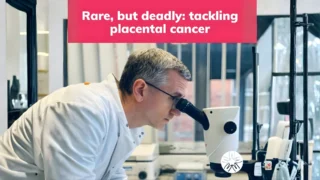 Personalised Diagnosis Could Transform Care for Rare Pregnancy Tumours - Wellbeing of Women