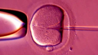 Diane Amedo: Revolutionary Egg Rejuvenation Technique