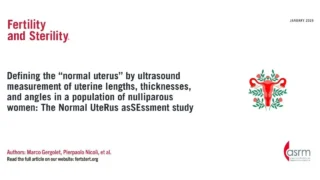 New Findings on Uterine Measurements in Nulliparous Women - Fertility and Sterility