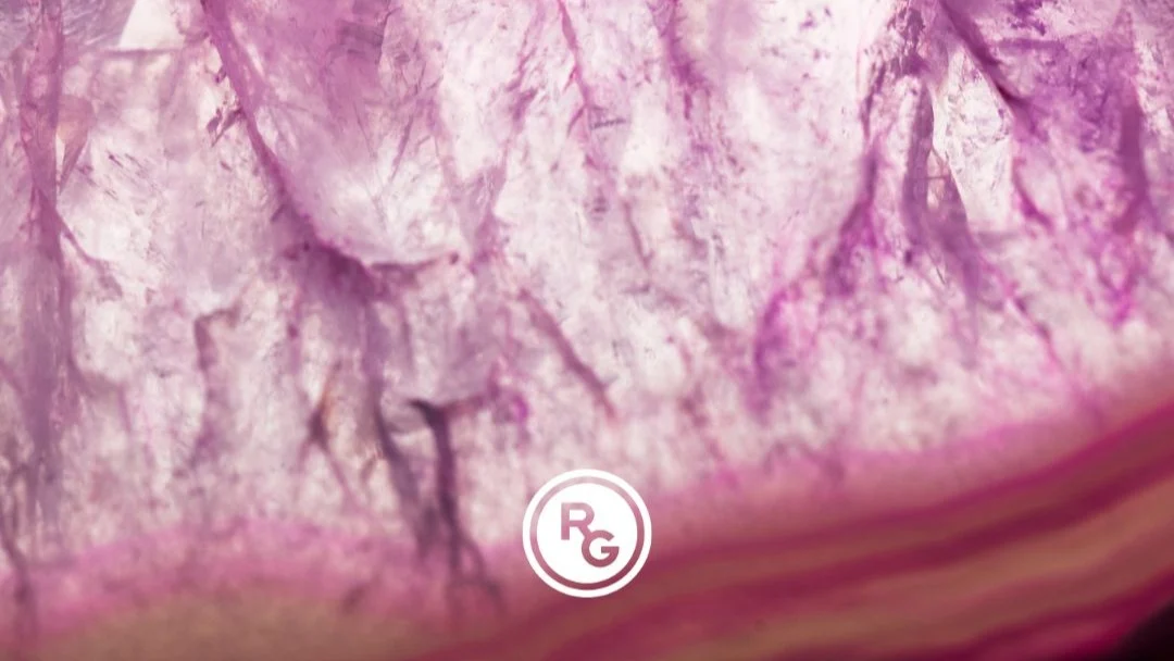 Understanding Hormonal Influences on Endometriosis Symptoms – Gedeon Richter France