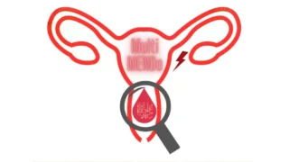 How Menstrual Blood Could Transform the Future of Endometriosis - MultiMENDo