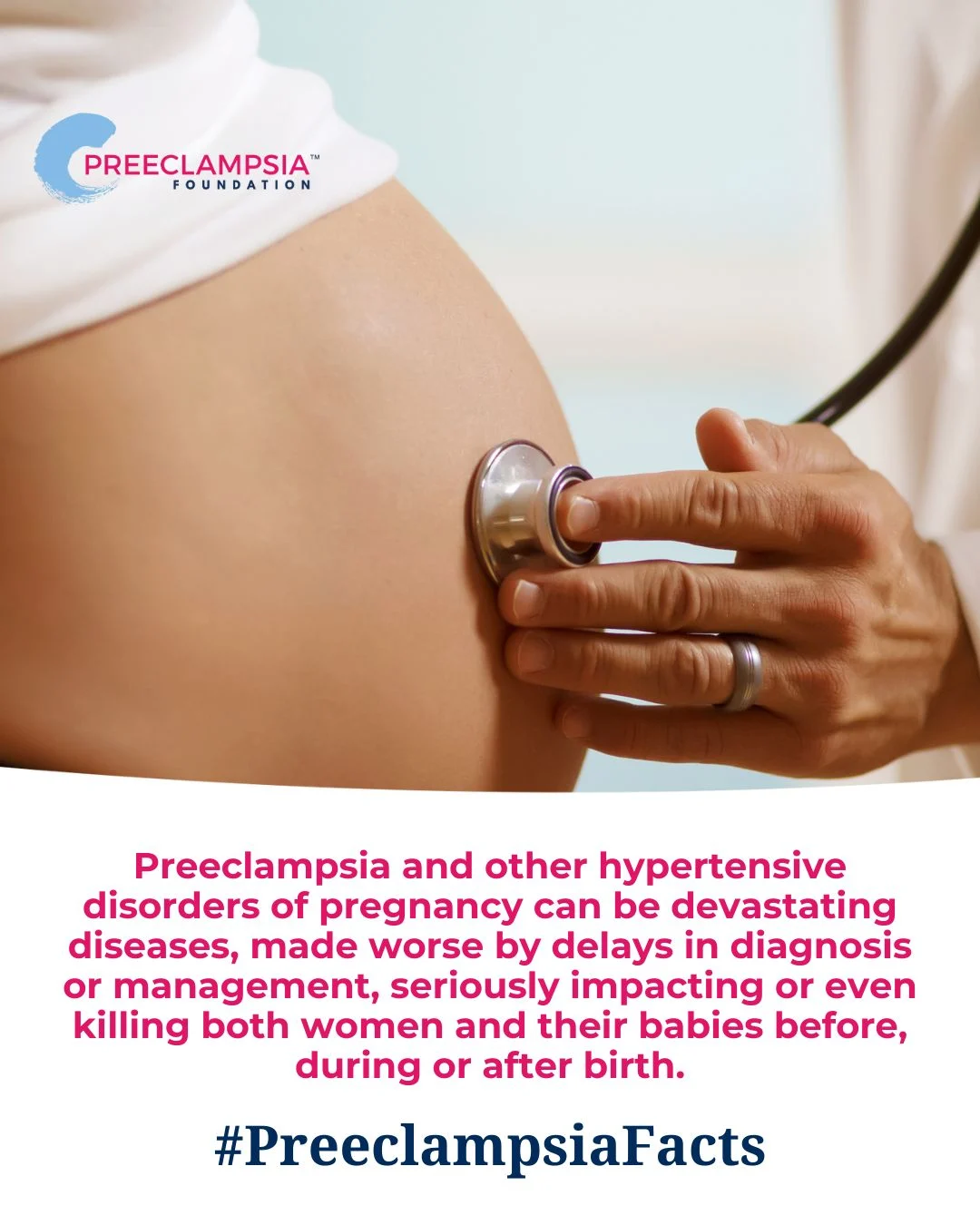 Preeclampsia Foundation Highlights Warning Signs of Preeclampsia in Pregnancy
