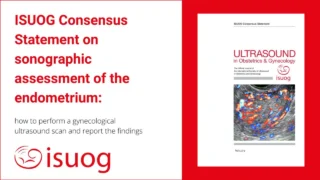 Latest ISUOG Consensus Statement on the Sonographic Assessment of the Endometrium