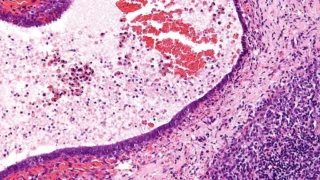 Ananda Pharma Cleared to Launch Phase 2 Trial for Endometriosis Pain Treatment - Cannabis Health