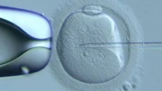 ARCS and BFS Publish Addendum to 2023 ICSI Guidelines - ARCS