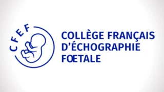 NIPT Accuracy in Twin Pregnancies with Early Fetal Loss - CFEF