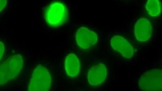 Streamline Your Assay Validation and QC Processes – Plasma Services Group