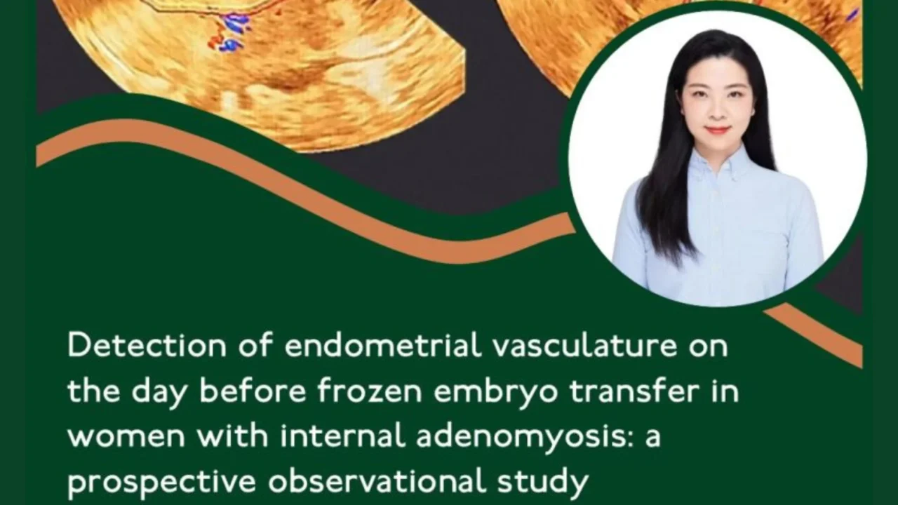 Predicting Pregnancy Outcomes in Adenomyosis with 3D Doppler – RBMO