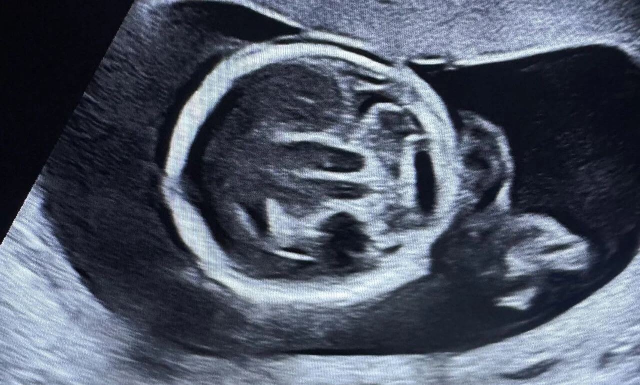 10 Fertility News Not to Miss This April!