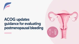 ACOG Publishes Updated Guidance on Evaluation of Postmenopausal Bleeding - ACOG