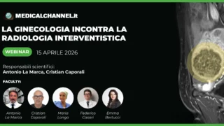 Antonio La Marca: Upcoming Webinar to Explore Uterine Artery Embolization and Thermal Ablation of Fibroids