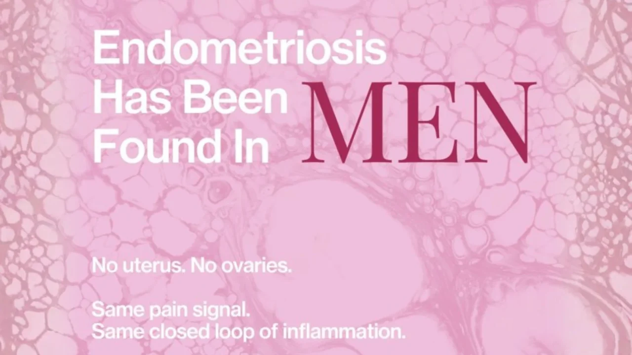 Rare Cases of Endometriosis in Men – Meliodays Medical