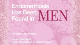 Rare Cases of Endometriosis in Men - Meliodays Medical