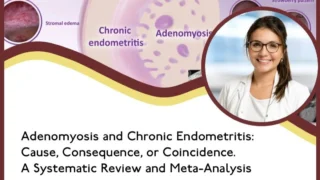 Association Found Between Adenomyosis and Chronic Endometritis - RBMO