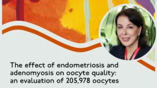 Effect of Endometriosis and Adenomyosis on Oocyte Quality and Morphology - RBMO