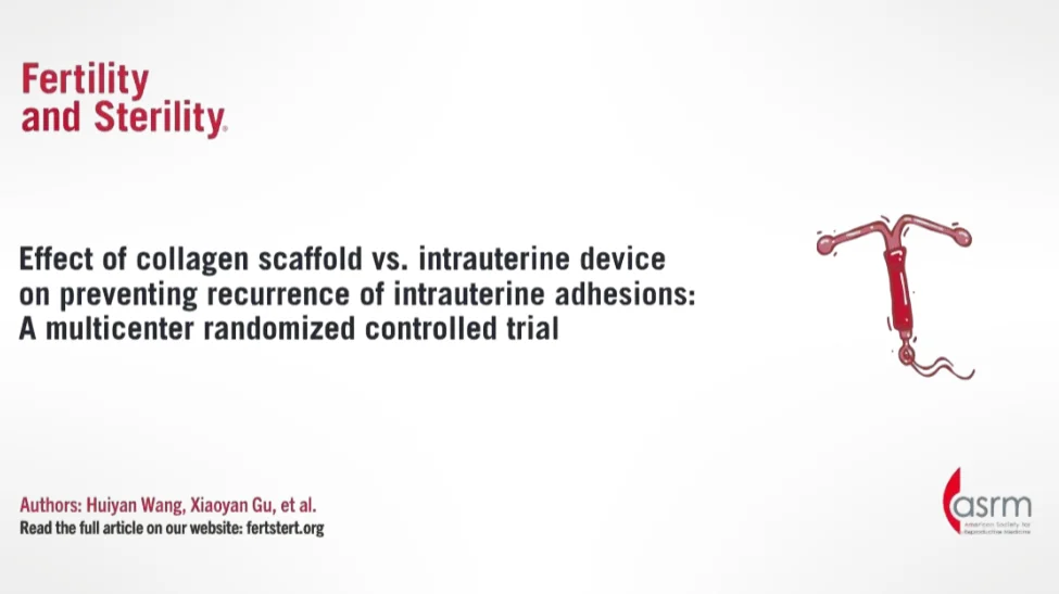 Effect of Collagen Scaffold Vs. IUD on Preventing Recurrence of Intrauterine Adhesions – Fertility and Sterility