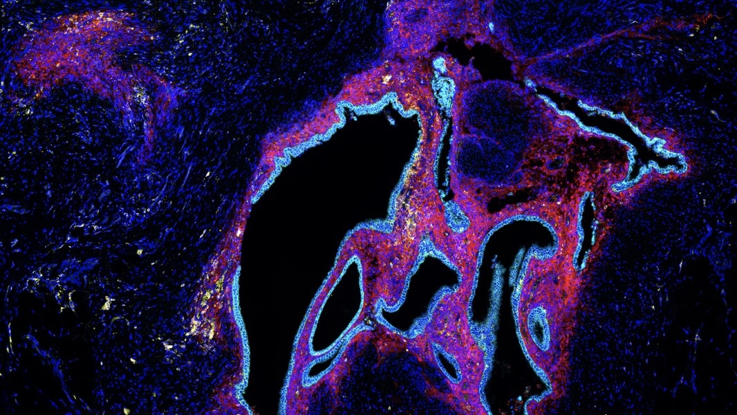 EndoRISE, A New Statewide Model for Endometriosis Care and Research – The Jackson Laboratory