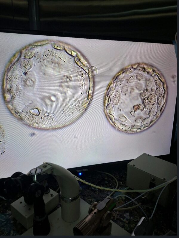 Ajay Barman: A Day With Good and Bad Blastocyst Embryos 