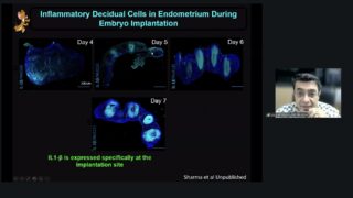 Arpan Christian: The Triad of Life, Who Determines IVF Success?