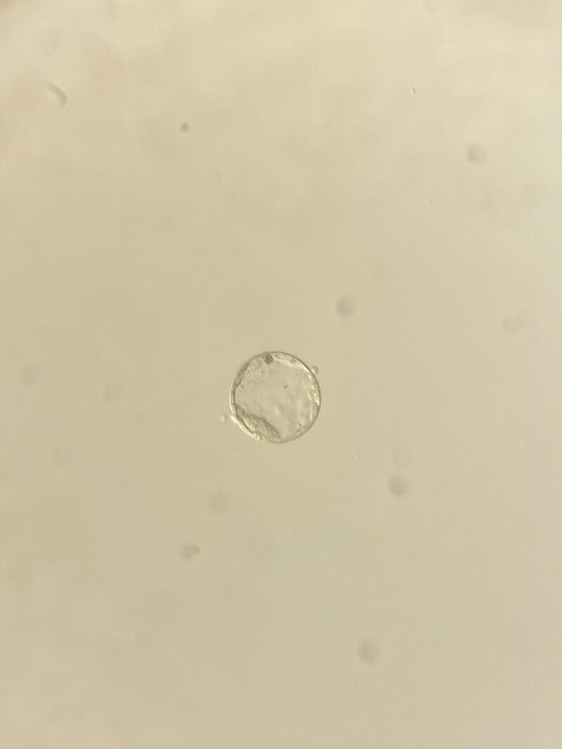 Sima Alnamoora: Day 5 Early Hatching Blastocyst Captured During IVF Cycle Monitoring
