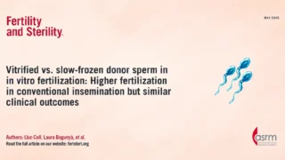 Vitrified vs. Slow-Frozen Donor Sperm in IVF - Fertility and Sterility