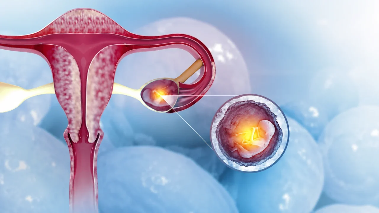 Sometimes the Signs Are Subtle, and Sometimes the Answers Are Not Immediately Visible on a Scan – The Ectopic Pregnancy Trust
