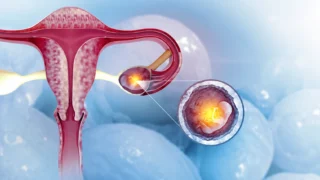 Sometimes the Signs Are Subtle, and Sometimes the Answers Are Not Immediately Visible on a Scan - The Ectopic Pregnancy Trust