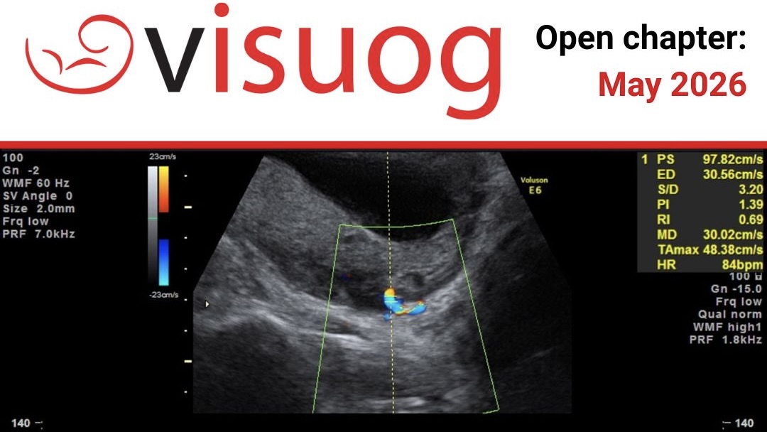 Discover the Power of Early Screening This Pre-Eclampsia Awareness Month – ISUOG