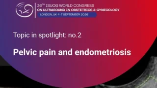 Pelvic Pain and Endometriosis Featured in ISUOG World Congress 2026 Programme - ISUOG