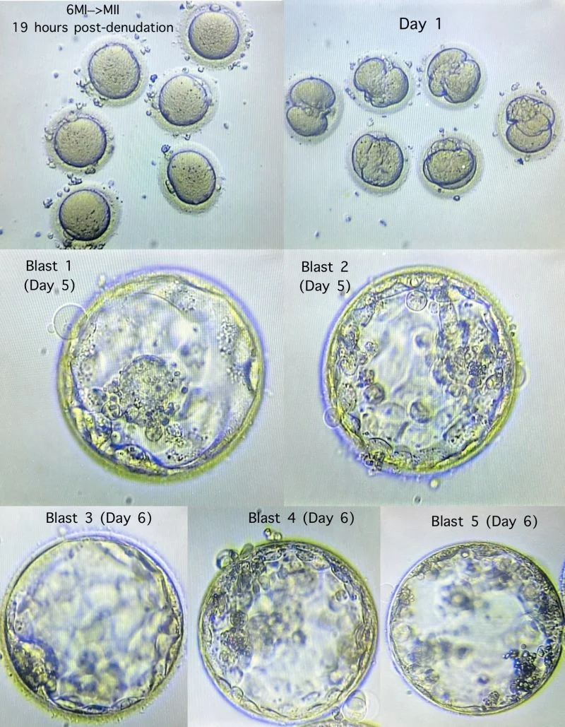 Ibukun Okanlawon: Blastocyst Development After Overnight IVM of MI Oocytes