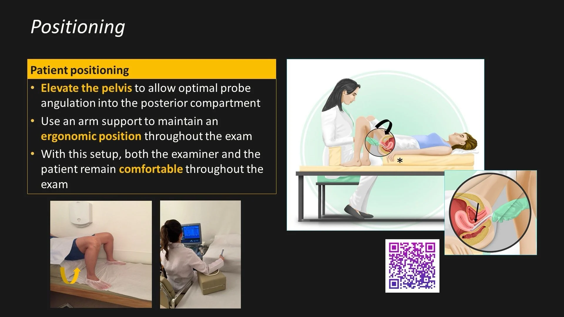 Luciana Chamie: My Go-To Tips for High Quality Dedicated Endometriosis Mapping TVUS