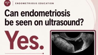 Mathew Leonardi: The Conversation Cannot Stop at Suspected Endometriosis