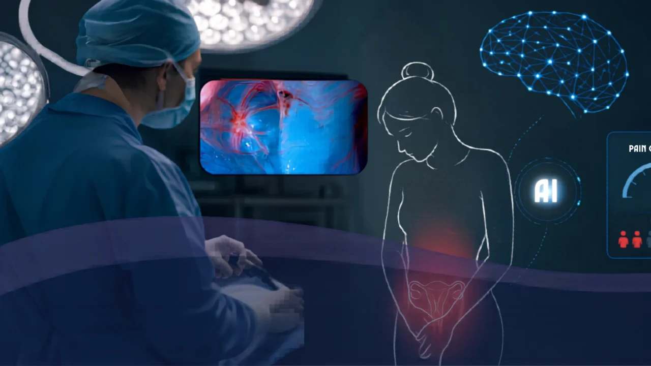 Predicting Pain Relief After Endometriosis Surgery – Seckin Endometriosis Center