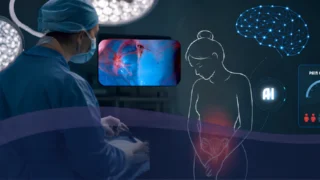 Predicting Pain Relief After Endometriosis Surgery - Seckin Endometriosis Center