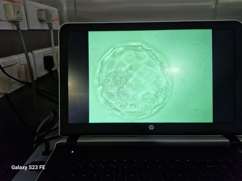 Silpi Saikia: Significant Milestone With Standard IVF Insemination