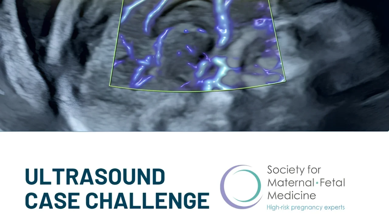 Emprove Your Diagnostic Skills With Ultrasound Case Challenge – The Society for Maternal-Fetal Medicine