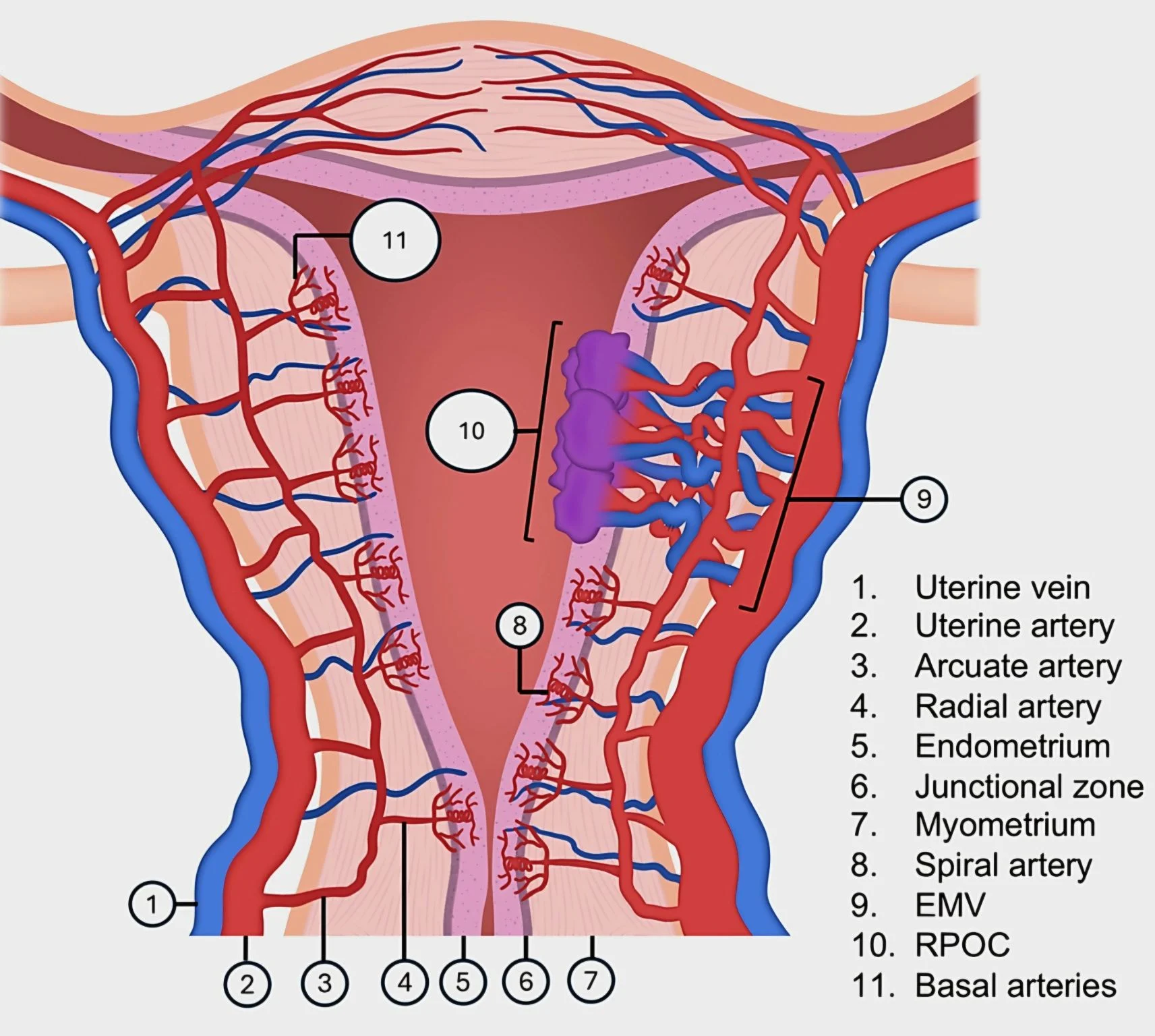 Marco Zaccaria: Enhanced Myometrial Vascularity: Ultrasound Findings and Clinical Context