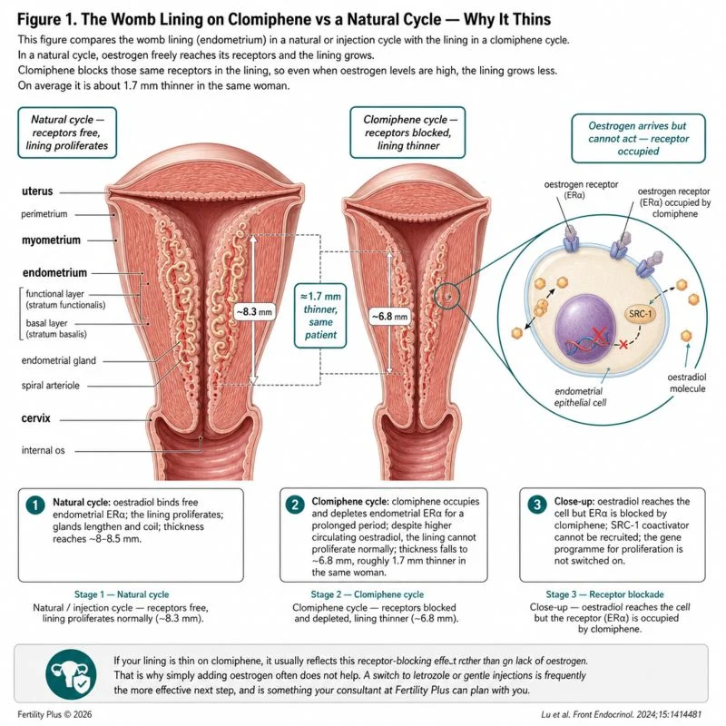 Clomiphene Can Quietly Thin Your Endometrium – Fertility Plus