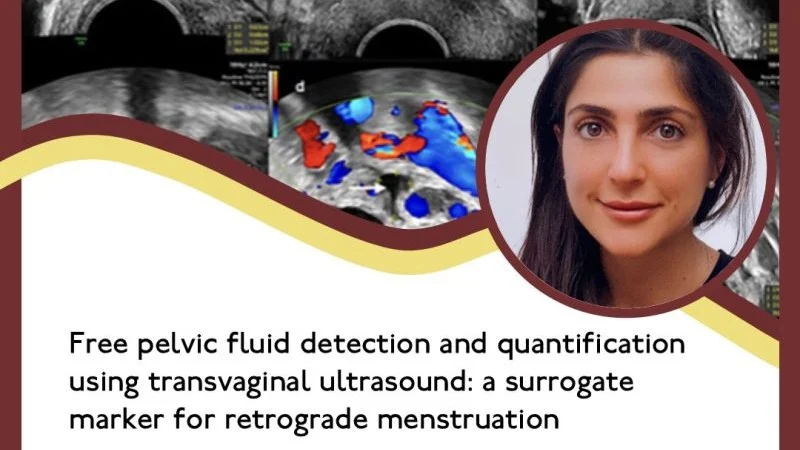 Free Pelvic Fluid Detection and Quantification Using Transvaginal Ultrasound – RBMO