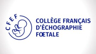 Diagnostic Challenge, Looking Beyond Renal Duplication and Ureterocele! - CFEF